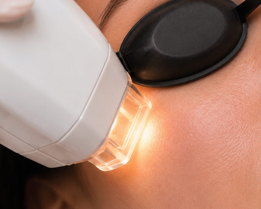 IPL Laser
