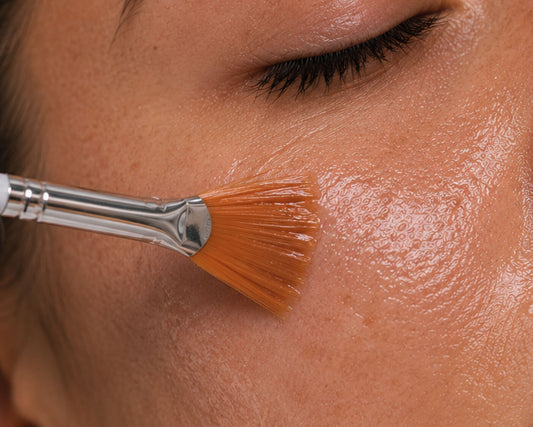 TCA Chemical Peel